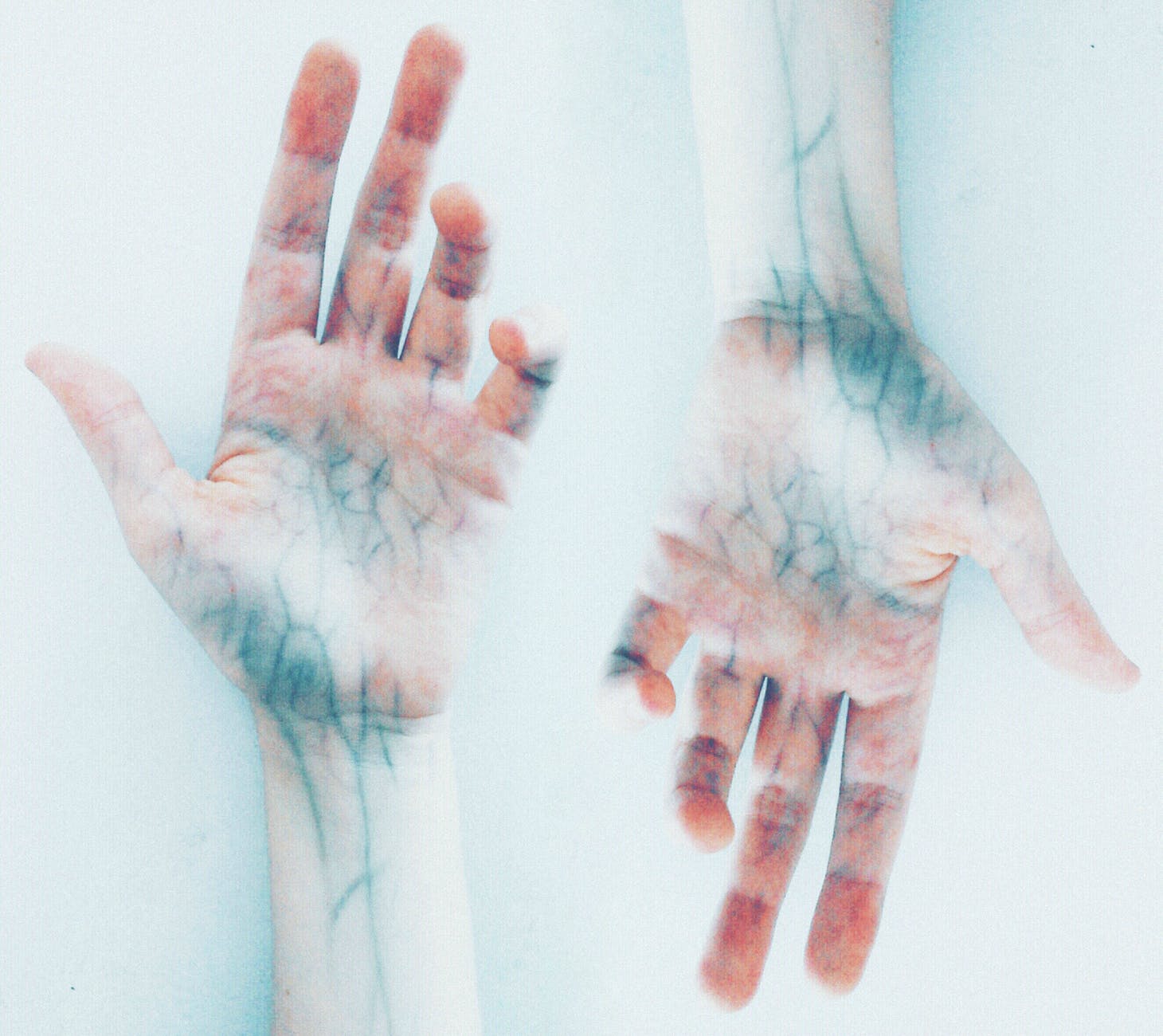 photo of hands with blue veins